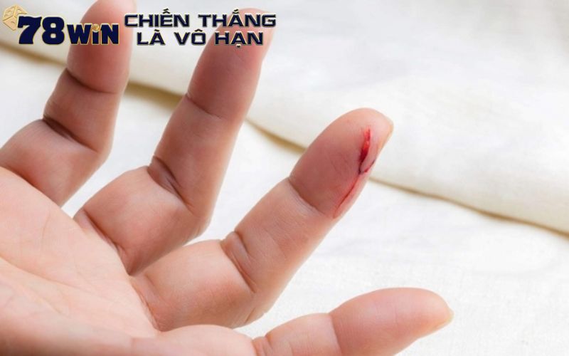 Giải mã chi tiết những giấc mơ thấy chảy máu tay 