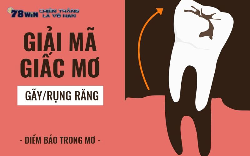 Mơ Rụng Răng - Giải Mã Ý Nghĩa Thực Sự Của Chiêm Bao