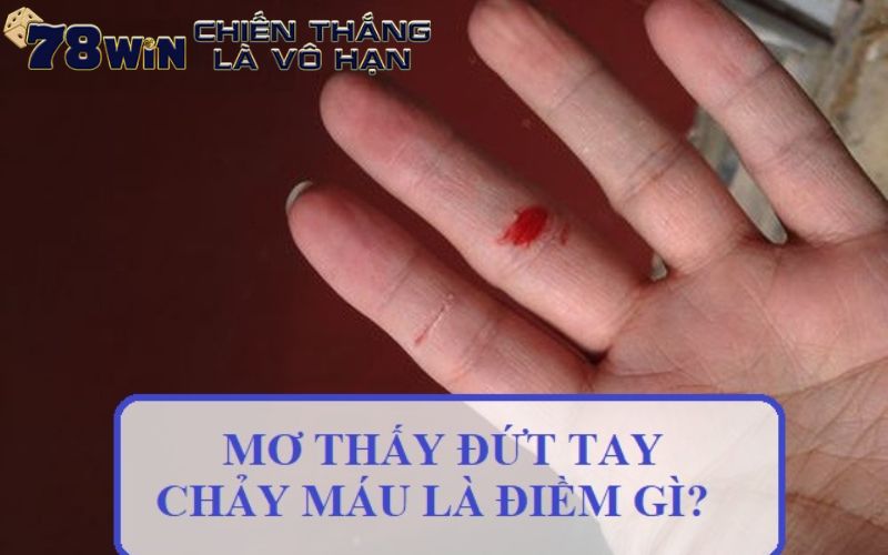 Mơ thấy chảy máu tay mang thông điệp tích cực hay tiêu cực 